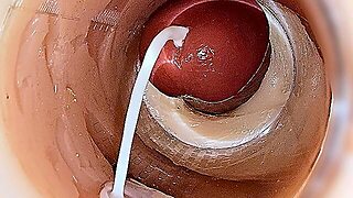 Camera Inside Deep Pussy Captures Huge Ejaculation Of Sperm