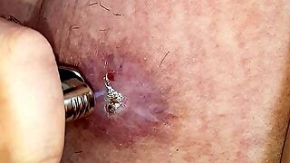 Burning The Tit Skin